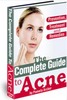 Thumbnail The Complete Guide to Acne Prevention, Treatment and Remedie