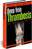Thumbnail Your Guide To Deep Vein Thrombosis Thumbnail Your Guide To Deep Vein Thrombosis